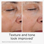 PREVAGE ANTI-AGING DAILY SERUM 2.0