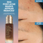 ADVANCED NIGHT REPAIR RESCUE SOLUTION SERUM WITH 15% BIFIDUS FERMENT