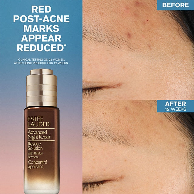 ADVANCED NIGHT REPAIR RESCUE SOLUTION SERUM WITH 15% BIFIDUS FERMENT
